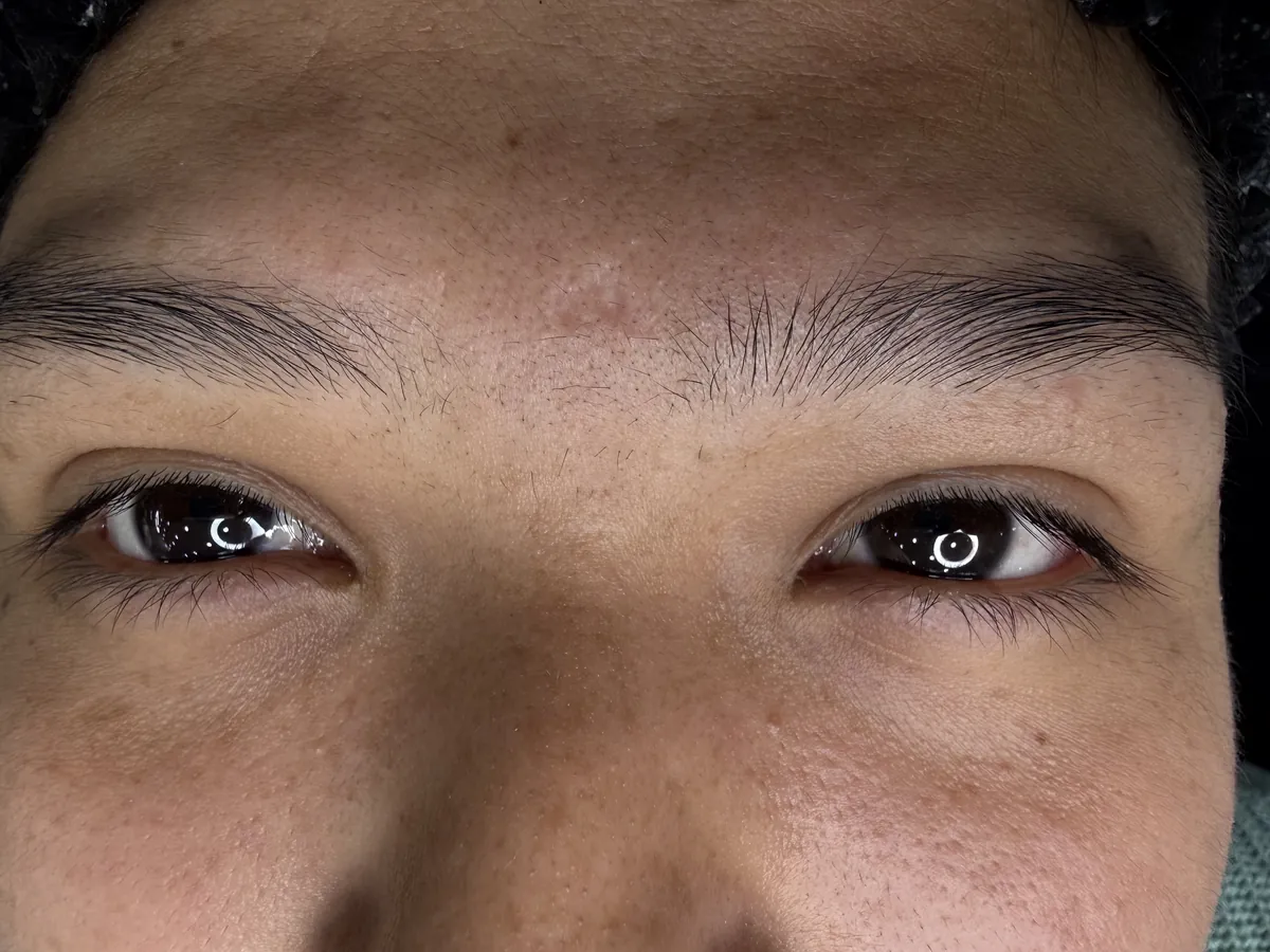 Cejas antes, poco pobladas y sin forma