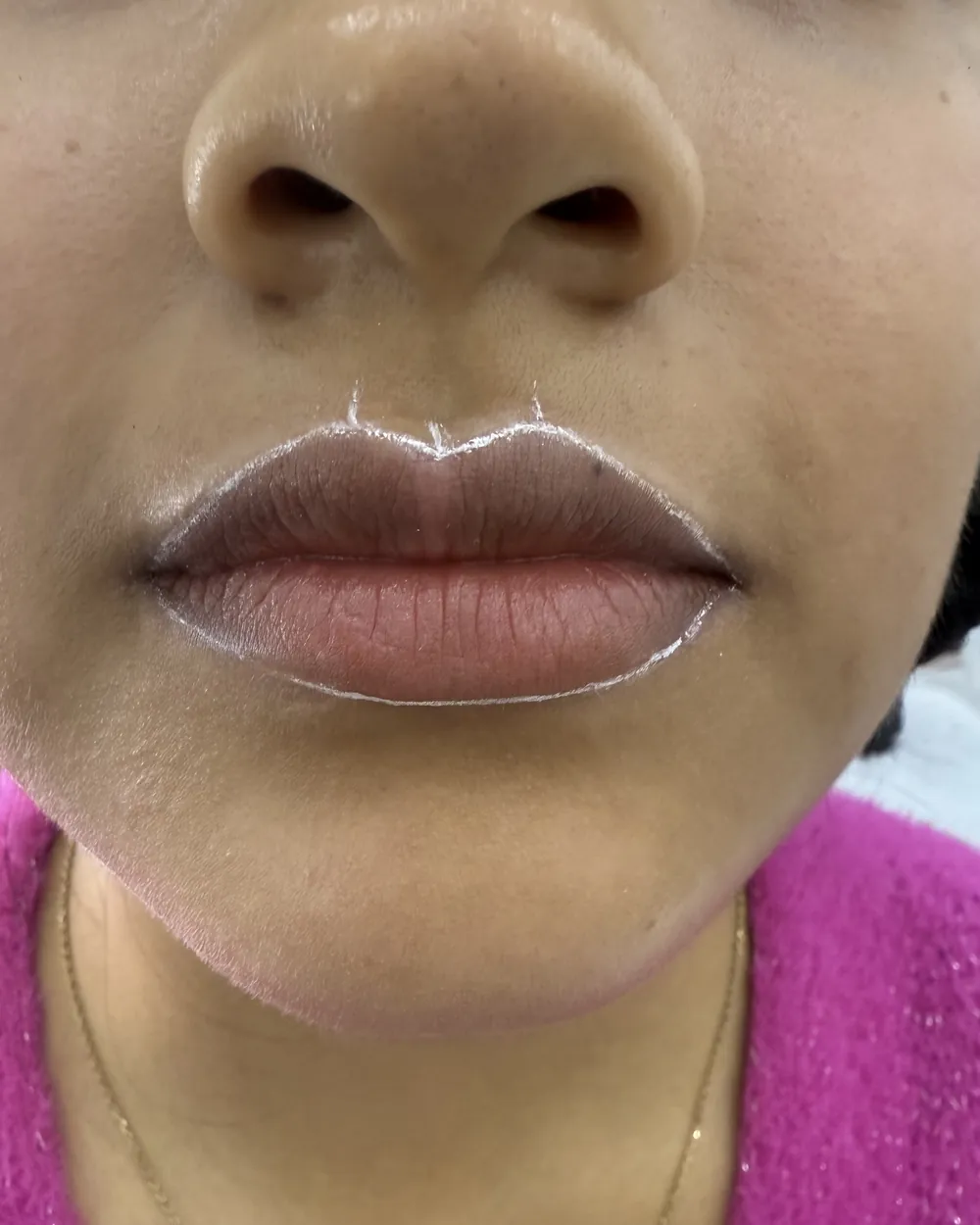 Diseño de labios marcado antes de pigmentar