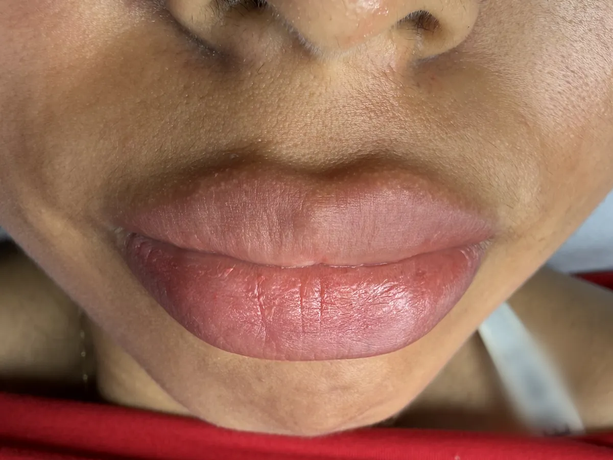 Labios después de la neutralización, con tono rosado